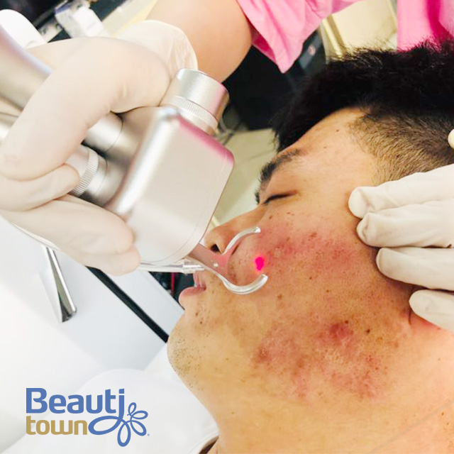 Professional Beauty Machine Co2 Fractional Laser Cost Uk