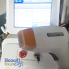 nd yag laser cost q switched tattoo removal device for sale