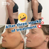 Hifu 9d Face Lift Ultrasound Skin Tighten Slimming Beauty Machine