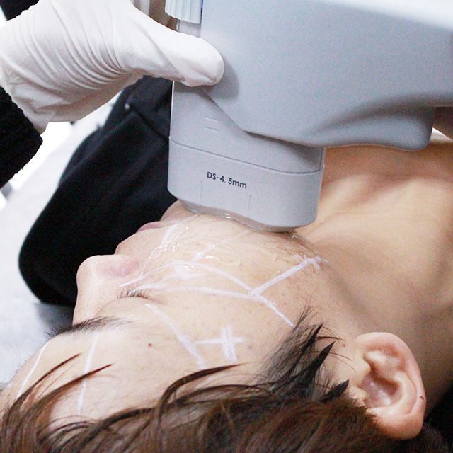 High Intensity Focused Ultrasound Ultrasonic Hifu Facial Machine for Beauty Salon